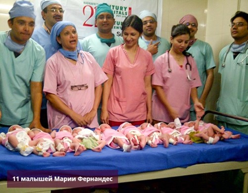Самое большое число одновременно рожденных близнецов - Российская газета